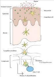 Titanium A New Allergen Intechopen
