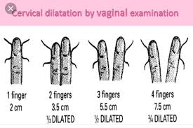 pictures and diagrams dilation effacement stations