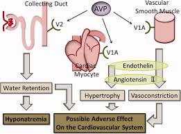 Siad In Elderly Pneumonia Patients Journal Of Hospital