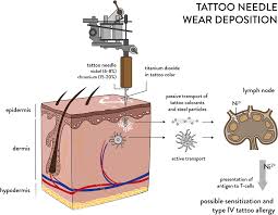 200 million users · free returns · free shipping Tattoo Needle Wear Biodistribution And Supposed Contribution To Allergy Download Scientific Diagram