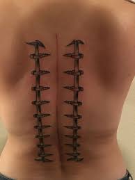 Back Tattoo Done In Honor Of My Son S Spinal Fusion Surgery Scoliosis Tattoo Spinal Tattoo Scoliosis