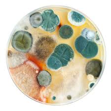 Schimmel Im Gartenhaus Tipps Zum Vorbeugen Und Entfernen In 2020 Petrischale Petrischalen Bio Art