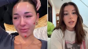 IS THIS THE END OF ANNA PAUL?