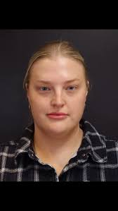 ✨ From every angle: sharper, sleeker, snatched. Chin lipo goals achieved.  💎 , ., ., ____________________, ☎️ 512-615-3280, 📧 info@dratencio.com,  www.westlakedermatology.com, ., ., ., ⚠️This is my ...