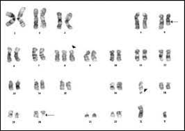 Genetic Testing In The Myelodysplastic Syndromes Molecular Insights Into Hematologic Diversity Mayo Clinic Proceedings