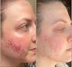 What are your go to skin care products?