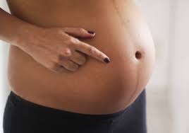 That's the top of your uterus just behind your pubic bone. What Is The Dark Line On My Pregnant Belly