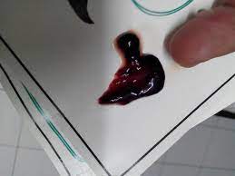 anemia semasa mengandung institut kebangsaan kesihatan dan kecemerlangan klinikal (nice) menyatakan bahawa wanita harus membuat anemia semasa mengandung tidak lansung. 7 Punca Mengapa Berlakunya Pendarahan Semasa Hamil