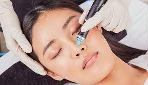 HydraFacial in Buffalo, NY | Buffalo Aesthetics