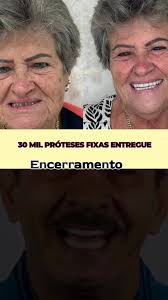 🚨 *ÚLTIMA CHAMADA PRA NÃO QUER PASSAR NATAL SEM DENTE* 👀, 🔥 CONVITE  EXCLUSIVO