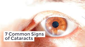 Consult a doctor for medical advice. 7 Symptoms Of Cataracts
