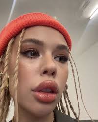 Инстасамка хочет помочь девочке из красного сулина. Instasamka Potrebovala Uvazheniya Kak Mogla Russkaya Telenedelya