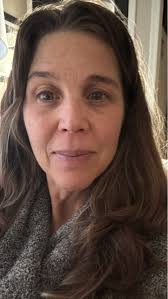 Bethany, 52, is 7 days after her Omakase Facelift®️She has a disarming,  gentle sweetness about her. Her surgery included:✓ Deep plane extended  facelift✓ Deep necklift (#neckbynayak)✓ Minimal incision browlift ✓ Upper  blepharoplasty