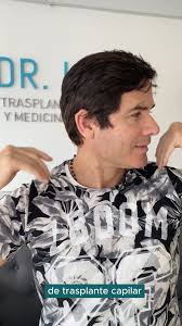 ✅👉 Joselito luce increíble gracias al trasplante capilar realizado por el  Dr. Lira, hoy goza de una mejor apariencia y autoestima. 🤩, 👤Dr. Fernando  Lira, Especialista Trasplante Capilar., 🌏WhatsApp: ...