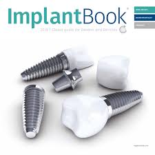 Implantbook 2019 By Infodent Srl Issuu