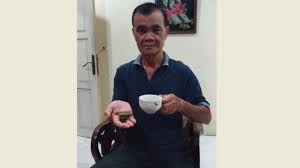 Penyakit kuning tapi bukan hepatitis. Minum Ramuan Akar Kuning Kakek Ini Sembuh Dari Hepatitis B Tribun Pontianak