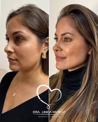 PRETTY FACE 😍 Un protocolo completamente personalizado para cada paciente.  Citas vía WhatsApp 321-812-9594