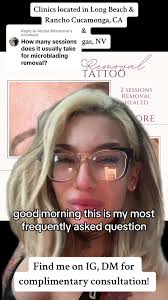 Alyssa Tattoo Removal