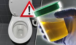 See the warning signs, causes, treatments, and prognosis for bladder cancer. Cancer Symptoms Healthy Urine Colour Revealed This Could Be Sign Of Blood In Wee Express Co Uk