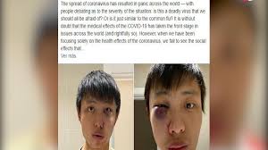 "Fuera tu coronavirus de mi país": el ataque racista a un joven de Singapur  en Londres