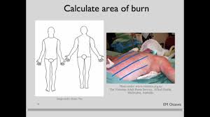The Quick And Dirty Guide To Burn Injuries Medictests Com
