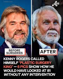 The truth is I don't know what I would have looked like if I hadn't done  it," Kenny stated, who later came to regret having the surgeries.😥  AI-created PICS of Kenny Rogers