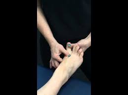 Dooley Noted Great Toe Compression And Bunion Bunion Remedies Bunion Bunion Exercises