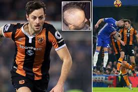 He proposed to her 10 weeks before his life altering injury. Ryan Mason Latest News Reaction Results Pictures Video The Mirror