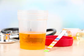 Image result for bacteria in urine