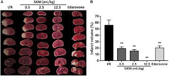 We did not find results for: Frontiers Tnfrsf12a Mediated Atherosclerosis Signaling And Inflammatory Response As A Common Protection Mechanism Of Shuxuening Injection Against Both Myocardial And Cerebral Ischemia Reperfusion Injuries Pharmacology