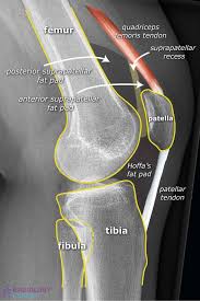 Image result for Knee XRay