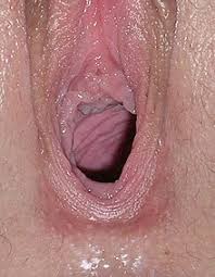 These are the external parts of the genitalia. Vagina Wikipedia
