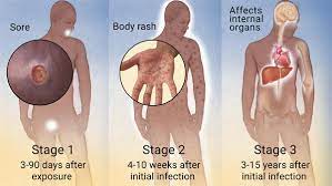 We did not find results for: Ik Heb Mijn Soa Niet Behandeld Wat Zijn De Risico S Treated Com