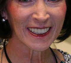 Hamblin Dental Implant and Aesthetic, 10011 S Centennial Pkwy, Ste 540,  Sandy, UT 84070, US