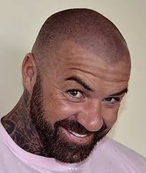 Hairline tattoo ink is completely organic. Hairline Inc Uk Leaders In Scalp Micropigmentation
