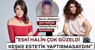 Maybe you would like to learn more about one of these? Deniz Akkaya Son Haliyle Takipcilerini Korkuttu Eski Halin Cok Guzeldi Keske Estetik Yaptirmasaydin Galeri Magazin
