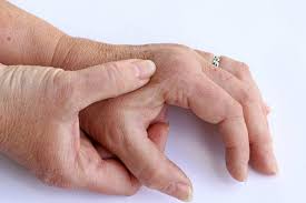 Fingerschmerzen Schmerzen In Den Fingern Ursachen Und Wirksame Behandlung Heilpraxis