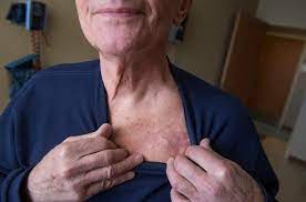 Il defibrillatore aed 3100 nihon kohden cardiolife rende tutto più facile, sicuro e rapido: Impianto Di Pacemaker O Defibrillatore Rischi E Complicanze
