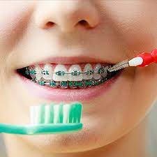 Why it's important to brush your teeth with braces Beat Dental Plaque While Wearing Braces With These Tools And Tips Gillette Dental Pc