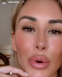 Anna Kane Is Back On Instagram