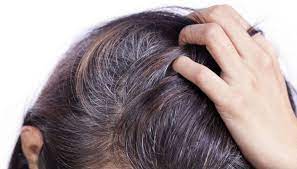 Neziha kalı ertuğrul/istock/gettyimages many people consider their hair — and hair color — to be part of their identity. White Hair At An Early Age Is Troublesome So Do Adopt These Traditional Methods Newstrack English 1
