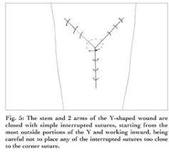 Image result for Corner Stitch