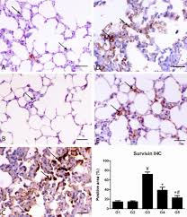 Image result for Pulmonary Intoxicant