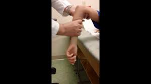 Image result for Elbow Dislocation