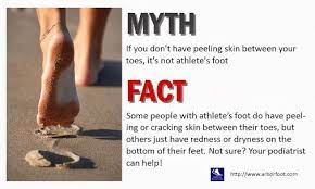 Fact Check Friday Can You Tell If You Have Athlete S Foot Dr Gary Prant Dpm Athletes Foot Facts Health Info