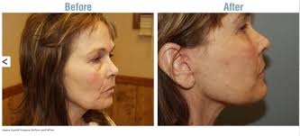 Wolf's Rejuvenation Center, 1 Marty Ln, West Alexandria, OH 45381, US