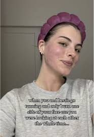 Burning When Tanning