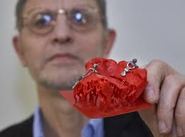 Recherche. Institut Jean-Lamour : confection d'implants 3D en Titanium  Niobium