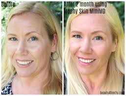 How to do a microdermabrasion at home & Giveaway!