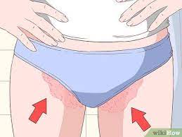Herausfinden Ob Du An Einer Pilzinfektion Im Leistenbereich Leidest 8 Schritte Mit Bildern Wikihow